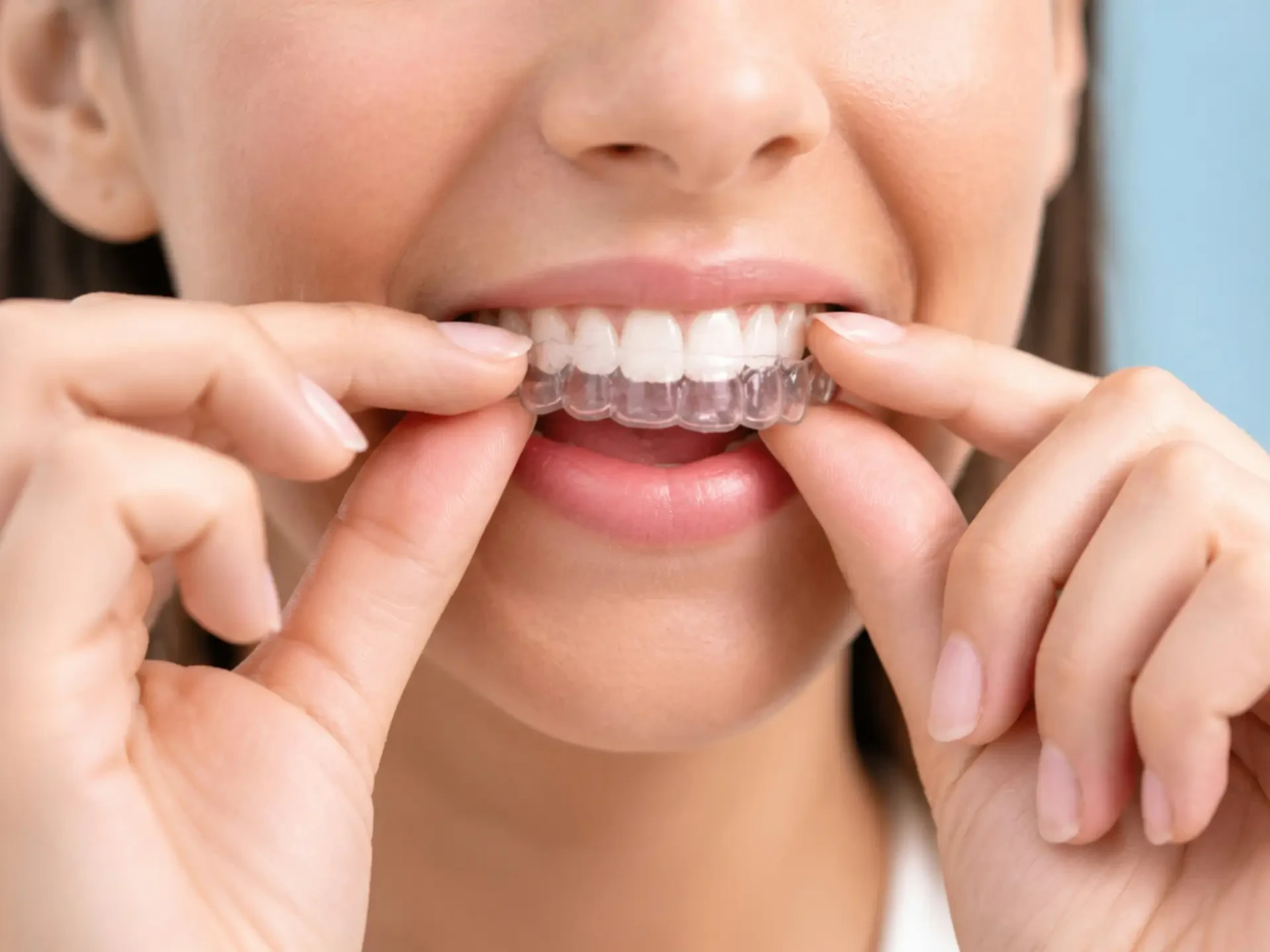Dental case 2