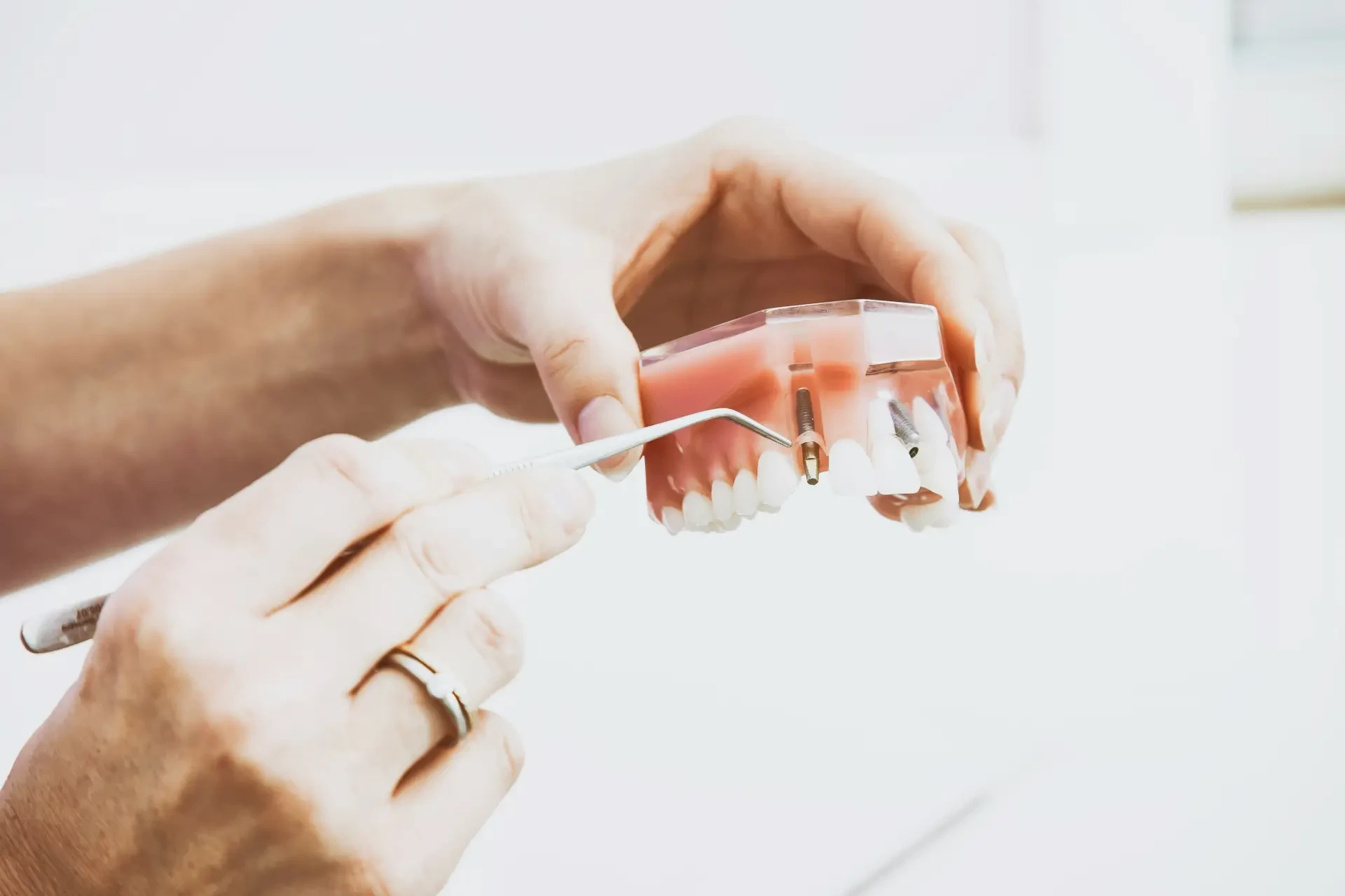 Dental case 4